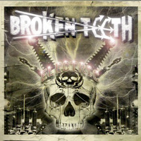 brokenteeth200